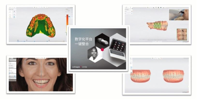 3Shape Unite platform